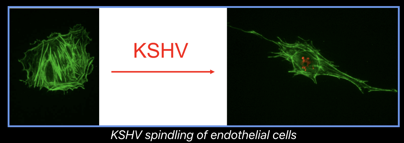 KSHV infection of endothelial cells