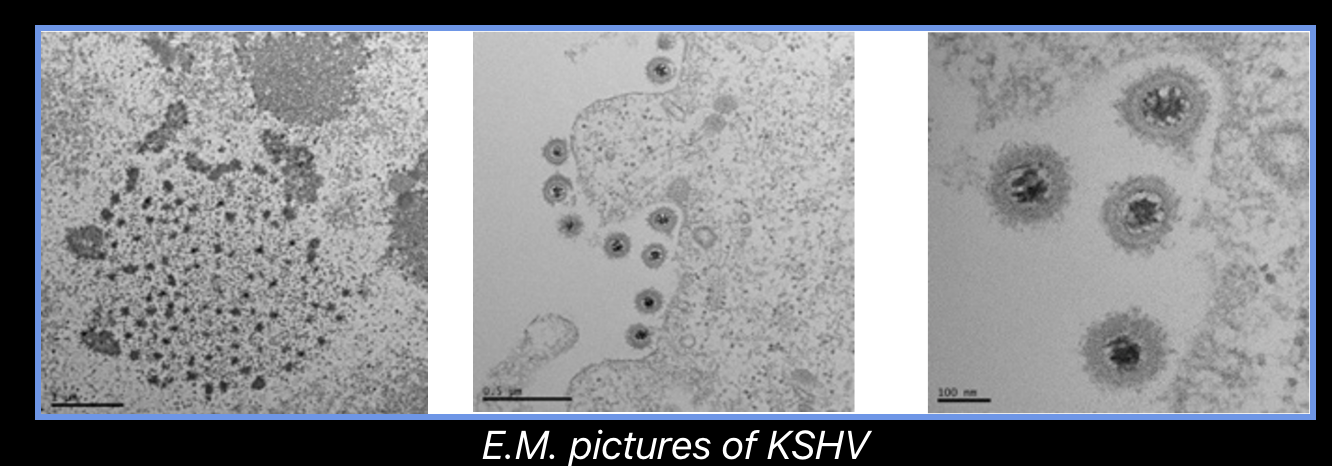 Electron Microscopy of KSHV 