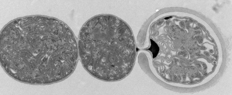 cyanobacteria